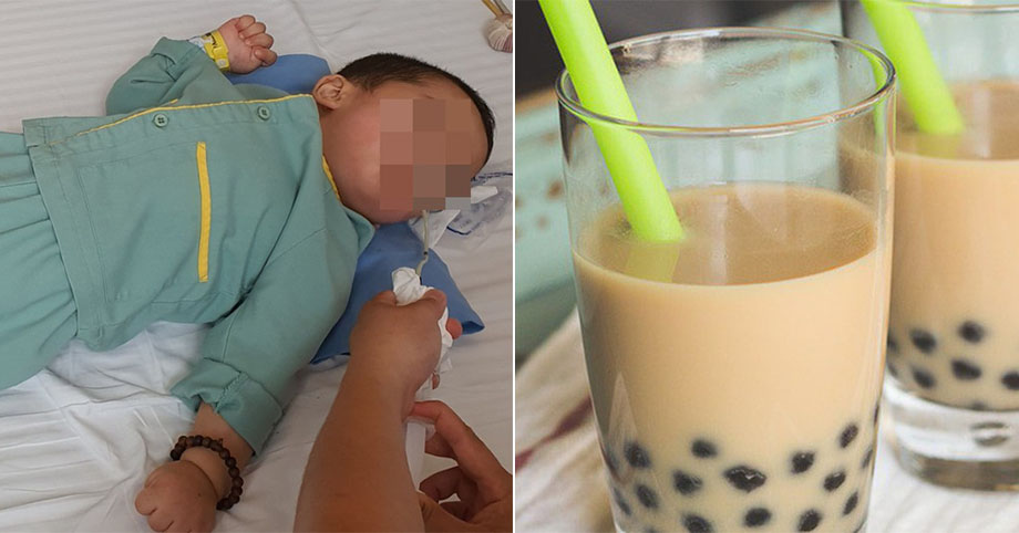Hóc thạch trong trà sữa trân châu, bé trai 21 tháng tuổi bị bại não