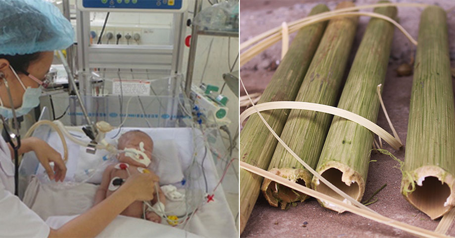 Bà dùng nứa 𝚌ắ𝚝 𝚍â𝚢 𝚛ố𝚗 cho cháu tại nhà, bé sơ sinh 𝚗𝚐𝚞𝚢 𝚔ị𝚌𝚑