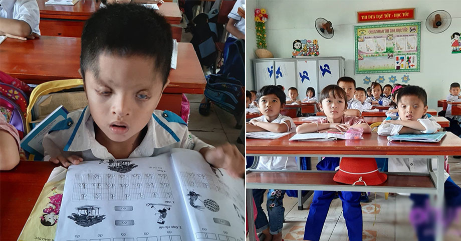 Nghị lực sống phi thường và khát vọng đến trường của cậu bé 6 tuổi có đôi mắt chỉ nhìn thấy 2% ánh sáng