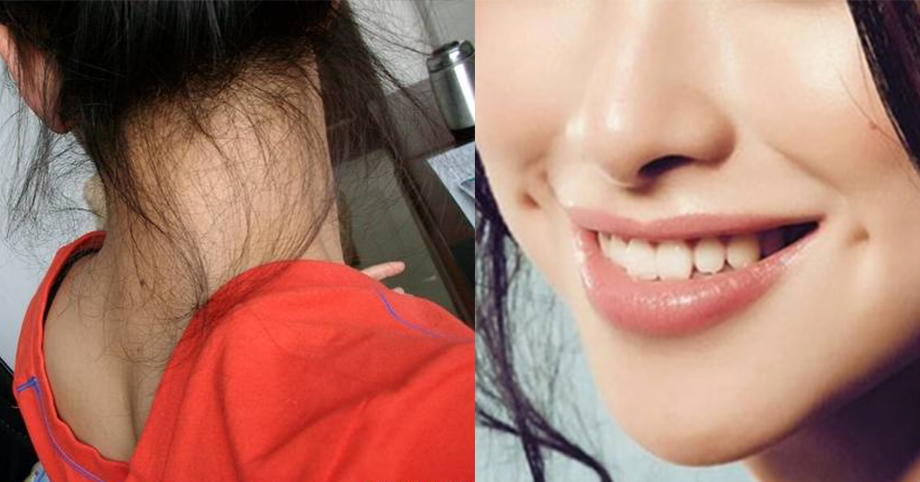 Các cụ dặn: má lúm đồng tiền, nốt ruồi trước ngực hay sau gáy, nhất định phải giữ
