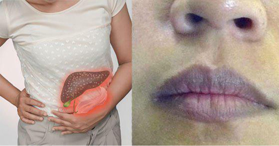 4 dấu hiệu trên miệng cảnh báo gan bị tổn thương nghiêm trọng, số 3 ai cũng bị nên dễ chủ quan