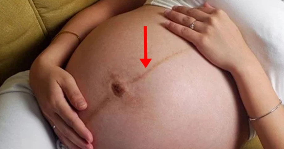 Sau khi mang thai, cơ thể có 4 vị trí chuyển sang màu đen, có chỗ màu càng sẫm thì thai nhi càng khỏe mạnh
