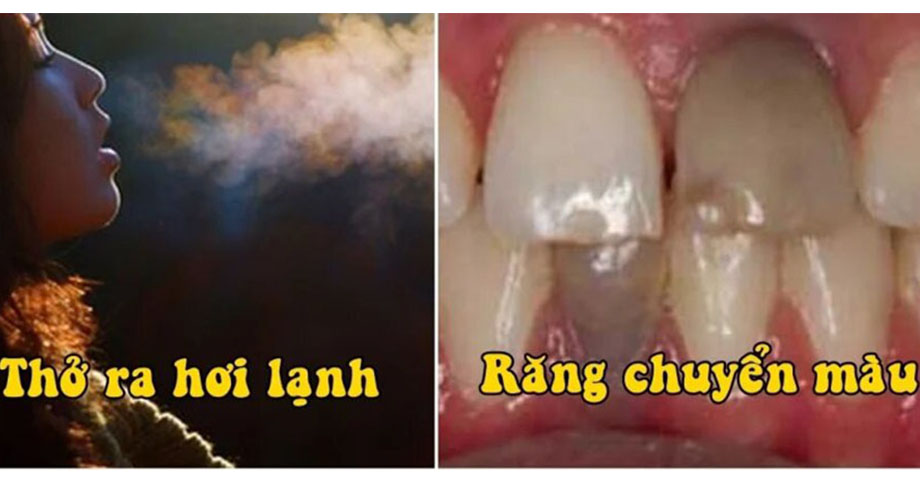 10 dấu hiệu kì lạ trên cơ thể báo trước bạn sắp gặp chuyện chẳng lành