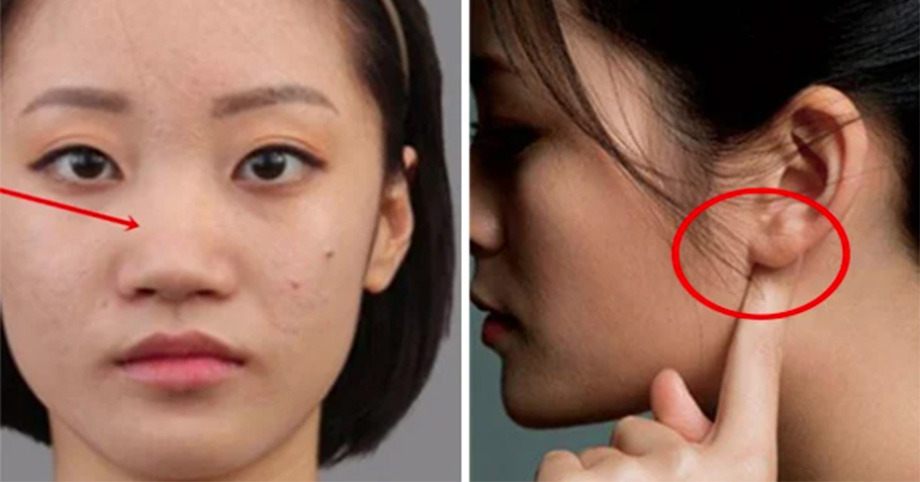 9 bộ phận trên khuôn mặt nếu phẫu thuật thẩm mỹ có thể thay đổi số mệnh