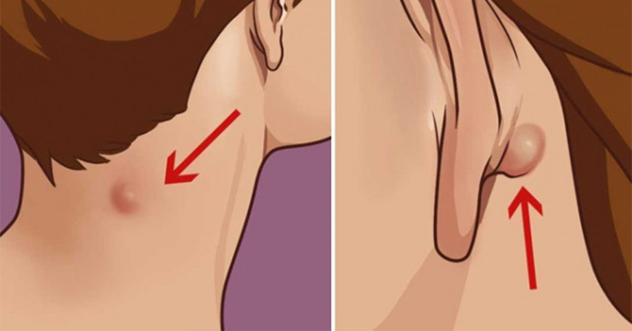 Nếu 3 bộ phận này trên cơ thể ‘nhô’ ra bất thường, hãy đi khám vì đó là dấu hiệu 𝚌ả𝚗𝚑 𝚋á𝚘 𝚋ệ𝚗𝚑 𝚗𝚐𝚞𝚢 𝚑𝚒ể𝚖