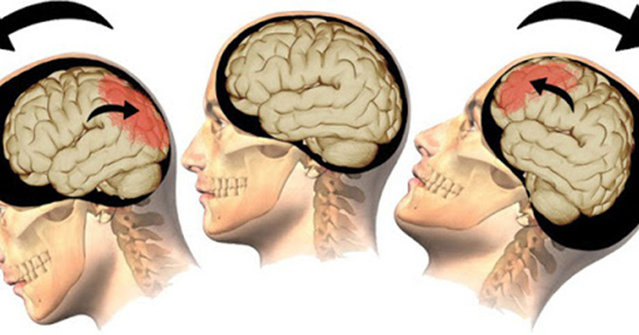 Nếu thấy 3 đặc điểm này trên mặt, chứng tỏ não bộ đang thiếu máu trầm trọng
