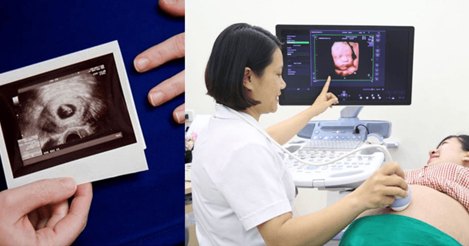 5 lần siêu âm cực quan trọng trong thai kỳ, mẹ bầu bận mấy cũng nhớ đừng bỏ qua