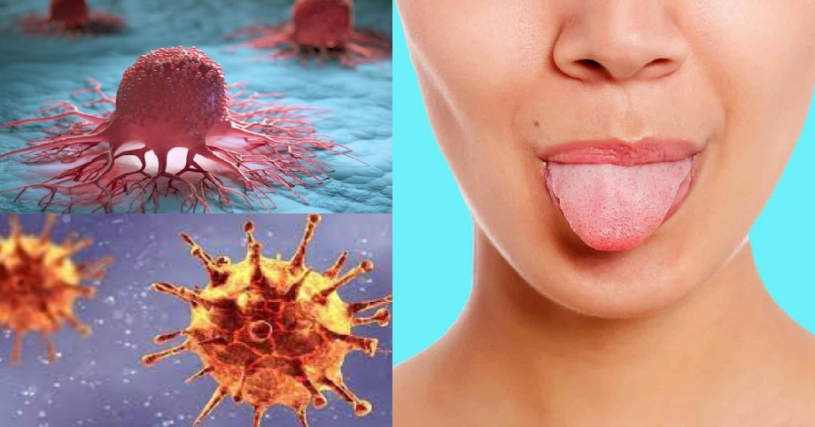 11 dấu hiệu ở lưỡi cảnh báo hàng loạt bệnh, từ COVID-19 đến 𝚞𝚗𝚐 𝚝𝚑ư