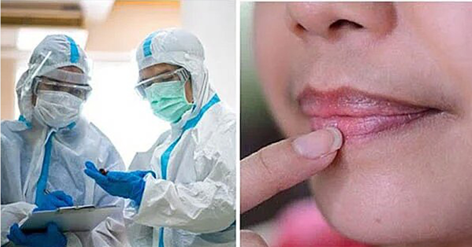 Triệu chứng nhiễm Omicron đặc trưng trên da, môi và móng tay: Phát hiện sớm sẽ tự cứu mình