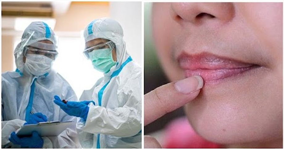 Triệu chứng nhiễm Omicron đặc trưng trên da, môi và móng tay: Phát hiện sớm sẽ tự cứu mình, ngừa trở nặng