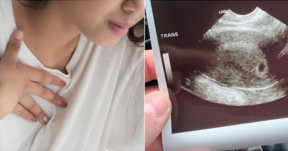 Buồn nôn, chán ăn hậu cô Vít, đi khám mới biết cấn bầu 4 tuần: Gì cũng đổ thừa cô Vi