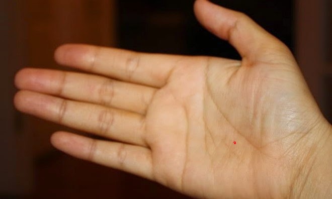 4 nốt ruồi ở lòng bàn tay tượng trưng cho Tài – Lộc – Phát – Thọ chỉ 1/4 cũng sung túc viên mãn