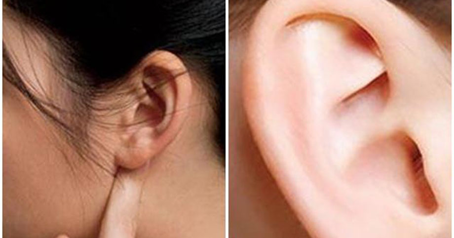 Nhìn màu sắc tai có thể nhận biết bệnh tiềm ẩn, đặc biệt nếu chuyển màu đen nên khám gấp