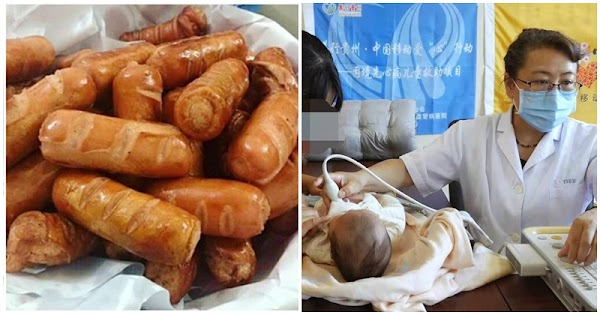 Chuyên gia cảnh báo: Cho trẻ ăn xúc xích mỗi ngày làm tăng 21% nguy cơ K trực tràng, dễ 𝚍ậ𝚢 𝚝𝚑ì 𝚜ớ𝚖