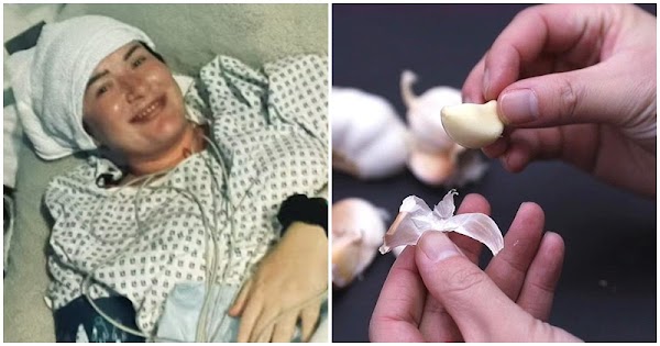 Người phụ nữ 45 tuổi bị 𝚞 á𝚌 𝚝í𝚗𝚑 ăn tỏi sống suốt nửa năm, kết quả thật bất ngờ
