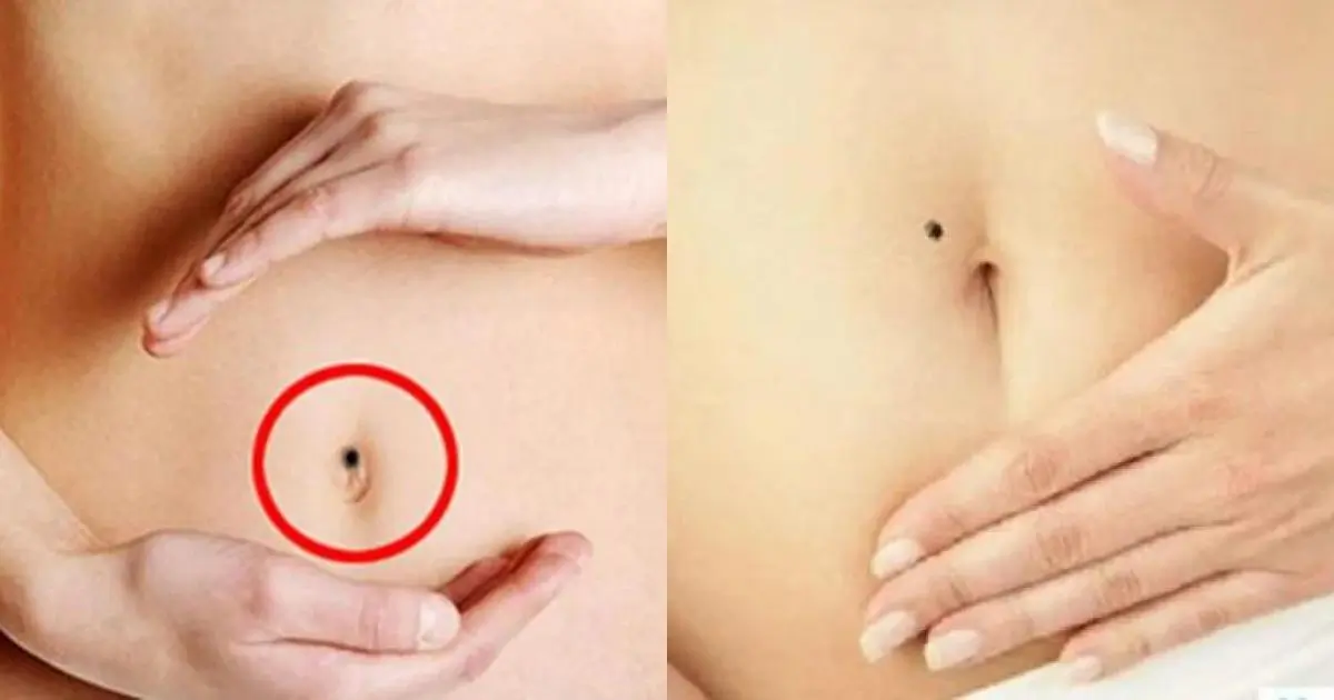 7 nốt ruồi ‘chỗ kín’ khiến chị em xấu hổ nhưng chính là quý tướng giàu sang, đừng vội tẩy đi mà мấᴛ lộc