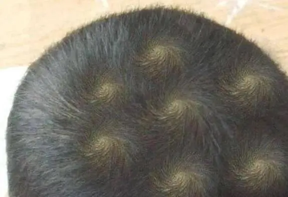 Mẹ chồng cho rằng cháu càng nhiều xoáy tóc càng thông minh, con dâu và con trai ‘đứng hình’ trước hành động của bà